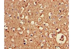 Immunohistochemistry of paraffin-embedded human brain tissue using ABIN7154637 at dilution of 1:100