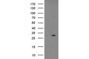 Western Blotting (WB) image for anti-Cyclin-Dependent Kinase Inhibitor 3 (CDKN3) antibody (ABIN1497461) (CDKN3 抗体)