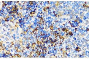 Immunohistochemistry of paraffin-embedded Mouse spleen using PBEF / NAMPT Polyclonal Antibody at dilution of 1:100 (40x lens). (NAMPT 抗体)