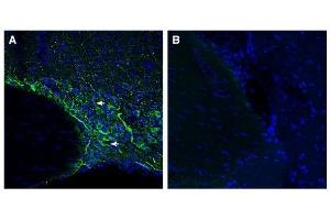 Immunohistochemistry (IHC) image for anti-Solute Carrier Family 5 (Iodide Transporter), Member 8 (SLC5A8) (AA 544-558), (Intracellular) antibody (ABIN7043734)