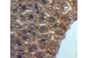 #VALUE! (LECT1 抗体  (AA 134-334))