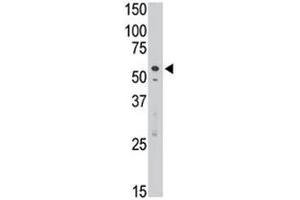 SIGLEC7 antibody used in western blot to detect Dsiglec/SIGLEC7 in Jurkat cell lysate (SIGLEC7 抗体  (AA 407-438))