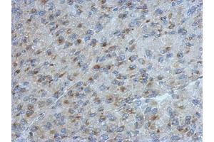 IHC-P Image Immunohistochemical analysis of paraffin-embedded U87 xenograft, using UGCGL2, antibody at 1:500 dilution. (UGCGL2 抗体)