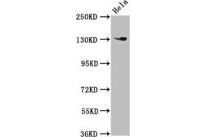 Western Blot Positive WB detected in: Hela whole cell lysate All lanes: NOMO1 antibody at 3 μg/mL Secondary Goat polyclonal to rabbit IgG at 1/50000 dilution Predicted band size: 135 kDa Observed band size: 135 kDa (NOMO1 抗体  (AA 918-1044))