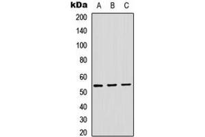 Western blot analysis of ADAMDEC1 expression in HEK293T (A), Raw264. (ADAMDEC1 抗体  (Center))