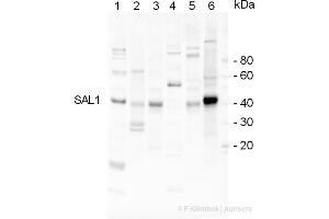 Western Blotting (WB) image for anti-Inositol Polyphosphate-1-Phosphatase (INPP1) antibody (ABIN334556) (INPP1 抗体)