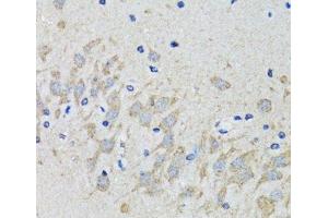 Immunohistochemistry of paraffin-embedded Mouse brain using HTR2B Polyclonal Antibody at dilution of 1:100 (40x lens).