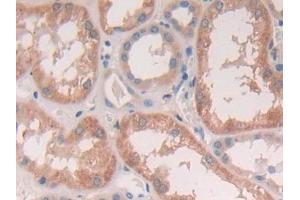 Detection of CTSS in Human Kidney Tissue using Polyclonal Antibody to Cathepsin S (CTSS) (Cathepsin S 抗体  (AA 115-331))