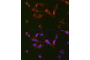 anti-Growth Differentiation Factor 15 (GDF15) (AA 49-308) antibody