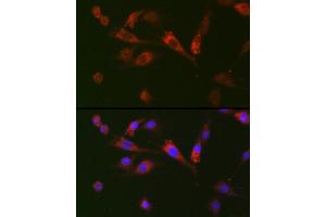 Immunofluorescence analysis of BALB-3T3 cells using GDF15 Rabbit pAb (ABIN3020658, ABIN3020659, ABIN3020660, ABIN1512942 and ABIN6213652) at dilution of 1:100 (40x lens). (GDF15 抗体  (AA 49-308))