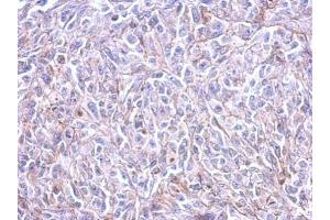 IHC-P Image Immunohistochemical analysis of paraffin-embedded HeLa xenograft, using Histamine H3 Receptor, antibody at 1:500 dilution. (HRH3 抗体  (C-Term))
