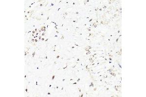 Immunohistochemistry of paraffin-embedded human uterus using FKBP5 antibody. (FKBP5 抗体  (AA 308-457))