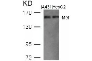 Image no. 1 for anti-Met Proto-Oncogene (MET) (AA 1001-1005) antibody (ABIN401652) (c-MET 抗体  (AA 1001-1005))
