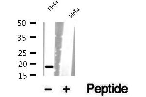 Western blot analysis of extracts of HeLa cells, using SRP14 antibody. (SRP14 抗体  (Internal Region))