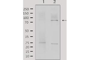 Western blot analysis of extracts from mouse brain, using MTA1 Antibody. (MTA1 抗体  (Internal Region))