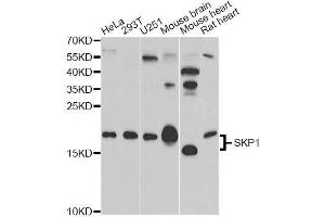 Western blot analysis of extracts of various cell lines, using SKP1 antibody. (SKP1 抗体)