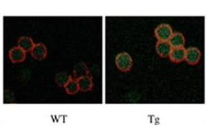 IF staining of Drak2 in WT versus Tg T cells. (DRAK2 抗体  (C-Term))
