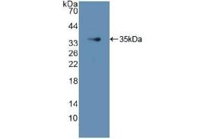 Detection of Recombinant GDI1, Human using Polyclonal Antibody to GDP Dissociation Inhibitor 1 (GDI1) (GDI1 抗体  (AA 1-274))