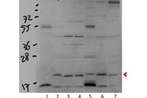 Western Blotting (WB) image for anti-Cytochrome C Oxidase Subunit IV Isoform 1 (COX4I1) (N-Term) antibody (ABIN2775574)