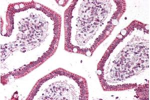Immunohistochemistry (IHC) image for anti-Phospholipase A2, Group IIA (Platelets, Synovial Fluid) (PLA2G2A) (Internal Region) antibody (ABIN2613468)