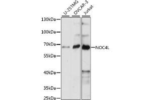 Western blot analysis of extracts of various cell lines, using NOC4L antibody (ABIN7269029) at 1:1000 dilution. (NOC4L 抗体  (AA 1-260))