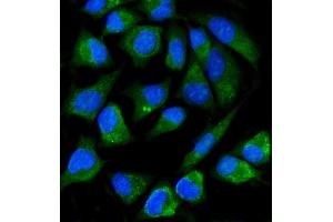 IF analysis of ALPP using anti-ALPP antibody (ABIN7602772).
