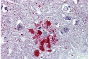 Human Brain, Cortex, Senile Plaque (formalin-fixed, paraffin-embedded) stained with Ubiquitin antibody ABIN462018 at 10 ug/ml followed by biotinylated anti-mouse IgG secondary antibody ABIN481714, alkaline phosphatase-streptavidin and chromogen. (Ubiquitin 抗体)