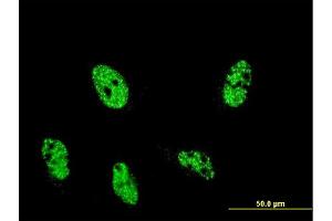 Immunofluorescence of monoclonal antibody to ARID4A on HeLa cell. (ARID4A 抗体  (AA 1033-1139))