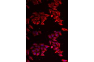 Immunofluorescence analysis of HeLa cells using SFRP4 antibody (ABIN5973810). (SFRP4 抗体)