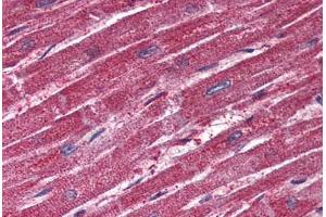 Anti-TRPM4 antibody  ABIN1049432 IHC staining of human heart.