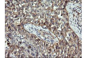 Immunohistochemistry (IHC) image for anti-T-cell surface glycoprotein CD1c (CD1C) antibody (ABIN2670676) (CD1c 抗体)