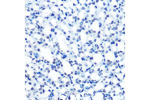 Immunohistochemistry of paraffin-embedded mouse kidney using  Rabbit mAb (ABIN7265458) at dilution of 1:100 (40x lens). (ADAR 抗体)