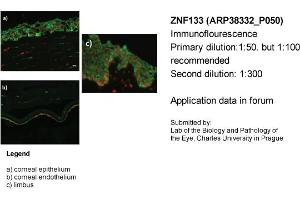 Image no. 2 for anti-Zinc Finger Protein 133 (ZNF133) (Middle Region) antibody (ABIN501662) (ZNF133 抗体  (Middle Region))