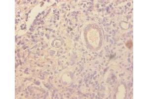 Immunohistochemistry of paraffin-embedded human kidney tissue using ABIN7177029 at dilution of 1:100 (CCL4 抗体  (AA 24-92))