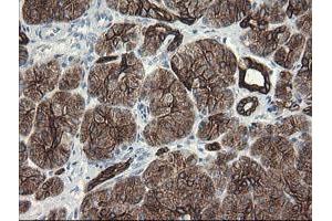 Image no. 9 for anti-Src-like-adaptor 2 (SLA2) antibody (ABIN1500949)