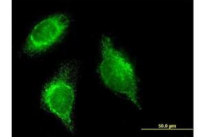 Immunofluorescence of monoclonal antibody to SFTPD on HeLa cell. (SFTPD 抗体  (AA 21-375))