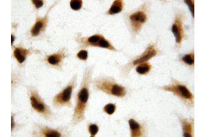 Anti-Apoptosis inhibitor 5 antibody, ICC ICC: HELA Cell (Apoptosis Inhibitor 5 抗体  (C-Term))
