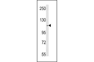 Western blot analysis of SKIV2L2 Antibody (Center) (ABIN652687 and ABIN2842458) in MCF-7 cell line lysates (35 μg/lane). (MTR4 抗体  (AA 237-263))