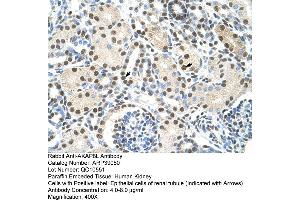 Human kidney (AKAP8L 抗体  (C-Term))
