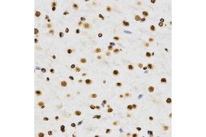 Immunohistochemistry (IHC) image for anti-Histone 3 (H3) (H3K9me2) antibody (ABIN3023260)