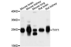 Western blot analysis of extracts of various cell lines, using THY1 antibody. (CD90 抗体  (AA 20-130))