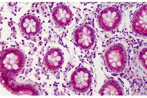 Anti-PPAR Delta antibody IHC of human colon. (PPARD 抗体  (AA 39-54))