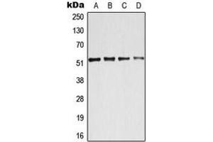 Western blot analysis of ATF2 expression in HeLa (A), MCF7 (B), NIH3T3 (C), PC12 (D) whole cell lysates. (ATF2 抗体  (N-Term))