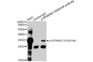 Immunoprecipitation analysis of 200ug extracts of 293 cells treated by PMA using 2. (RPS6 抗体  (pSer240, pSer244))