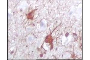 Immunohistochemistry (IHC) image for anti-S100 Calcium Binding Protein B (S100B) (full length) antibody (ABIN2464102)