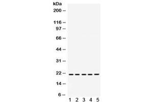 Western blot testing of 1) rat brain, 2) rat liver, 3) rat kidney, 4) human MCF7 and 5) human SW620 lysate with RAPA1 antibody. (RAP1A 抗体)