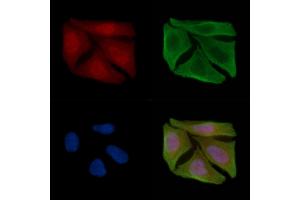 ABIN6255407 and ABIN6267589 staining Hela cells(30 min of UV treatment) by IF/ICC.