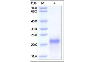 Biotinylated Human VEGF165 on SDS-PAGE under reducing (R) and no-reducing (NR) conditions. (VEGF Protein (AA 27-191) (Biotin))