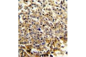Immunohistochemistry (IHC) image for anti-Neutrophil Cytosolic Factor 4, 40kDa (NCF4) antibody (ABIN3003340)