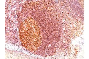 Formalin-fixed, paraffin-embedded human Tonsil stained with MALT1 Mouse Monoclonal Antibody (SPM578) (MALT1 抗体  (AA 701-808))